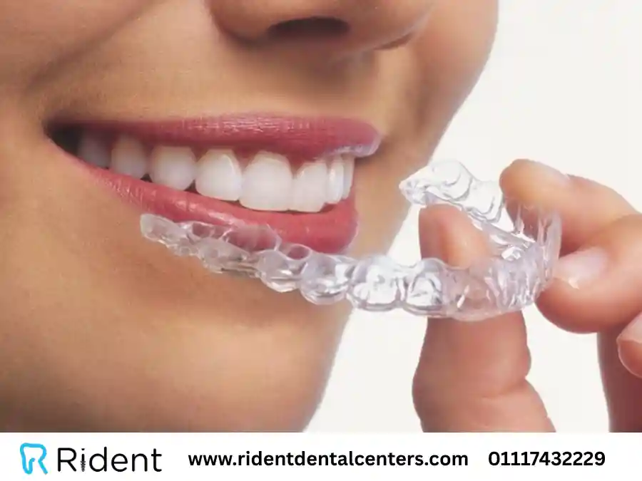 ما هي طرق تعديل الاسنان بدون تقويم ؟